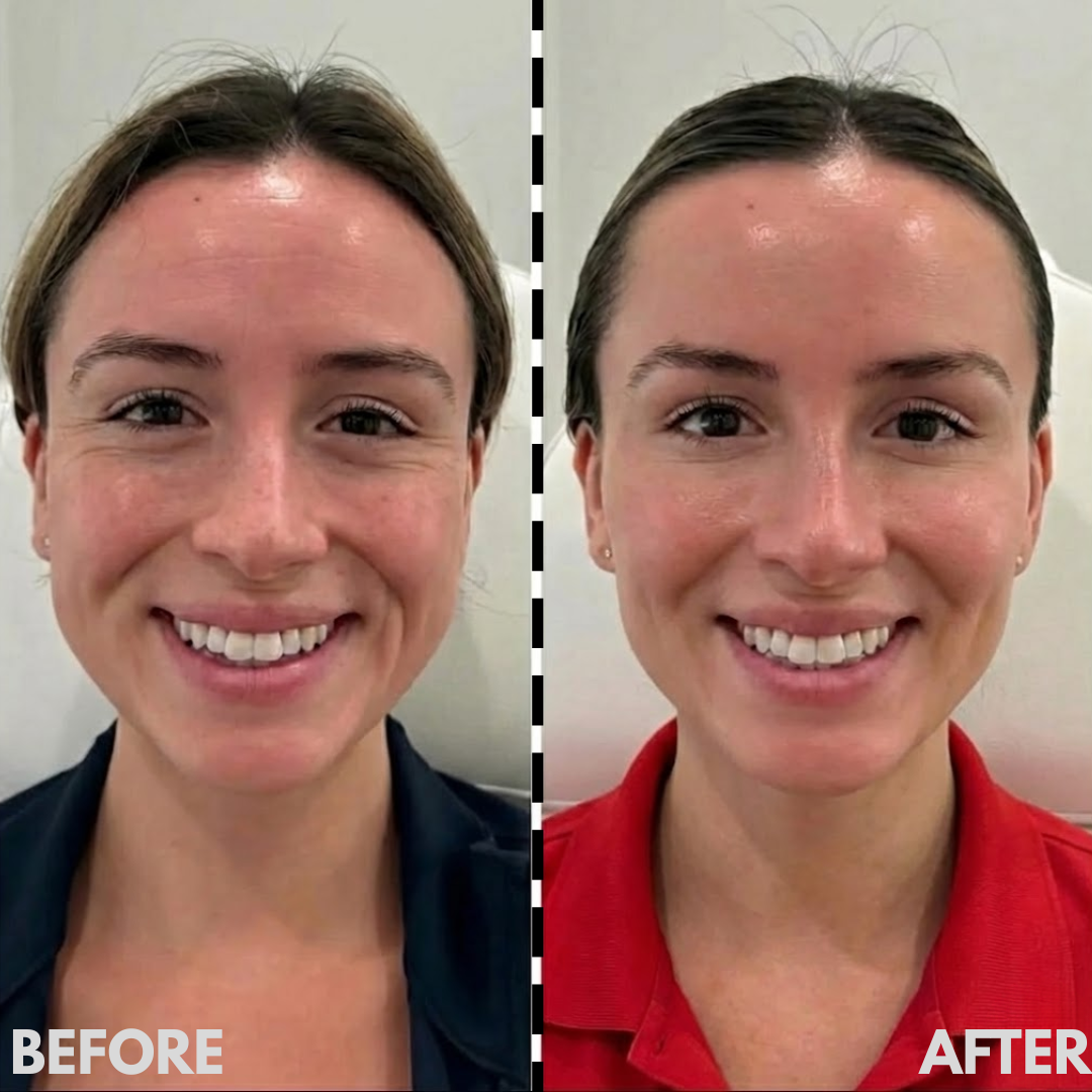 AESTHERA™ V-Sculpt Pro EMS