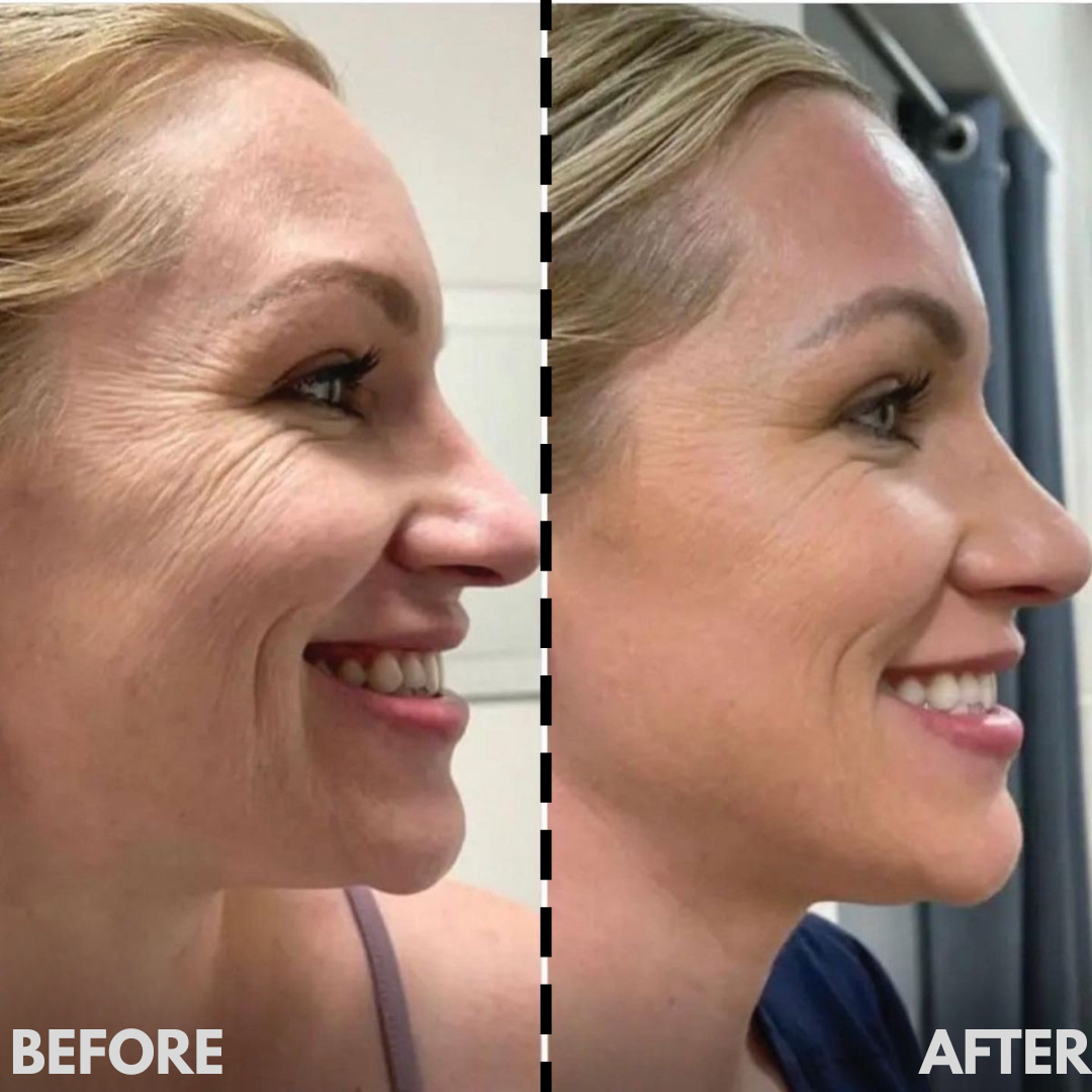 AESTHERA™ V-Sculpt Pro EMS