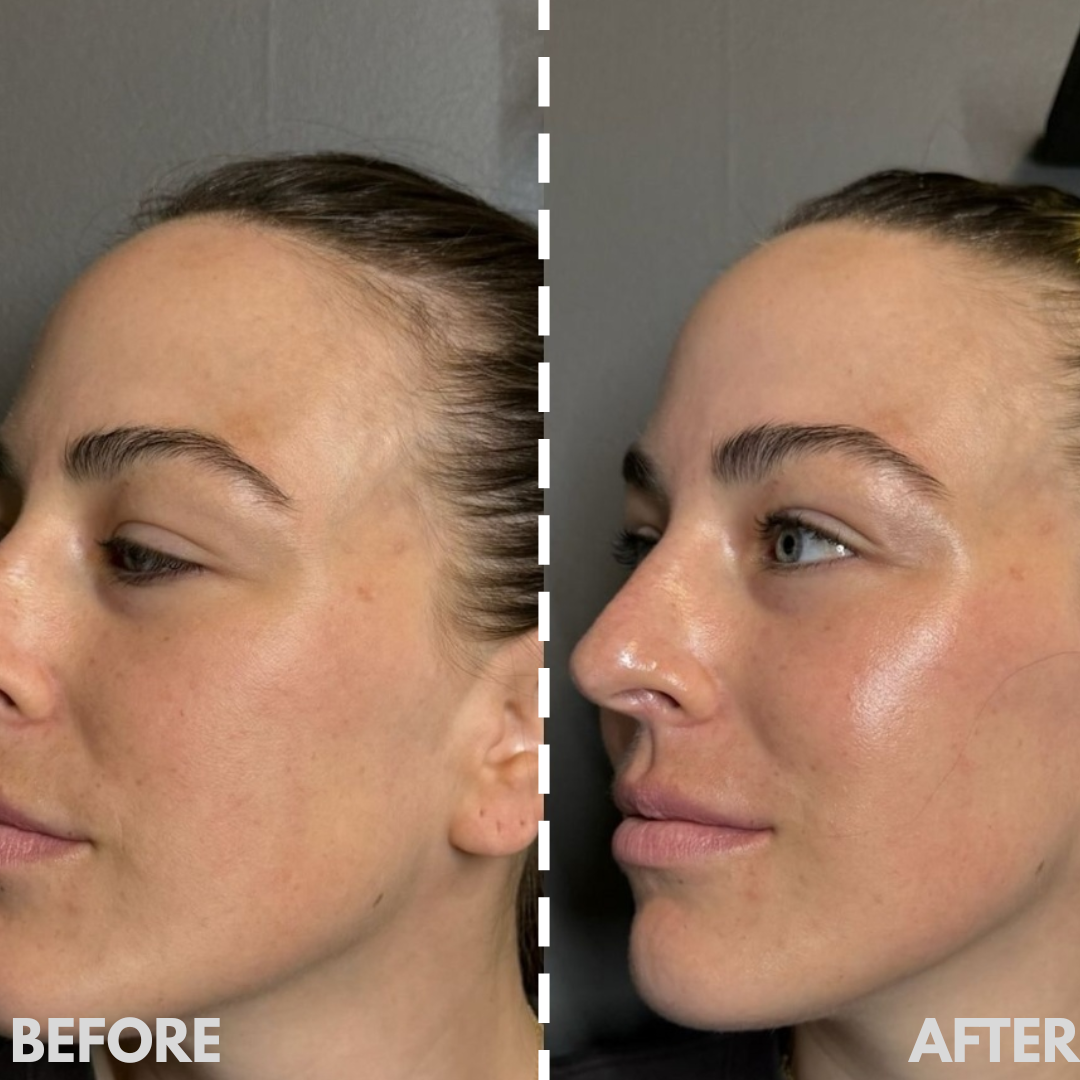 AESTHERA™ V-Sculpt Pro EMS